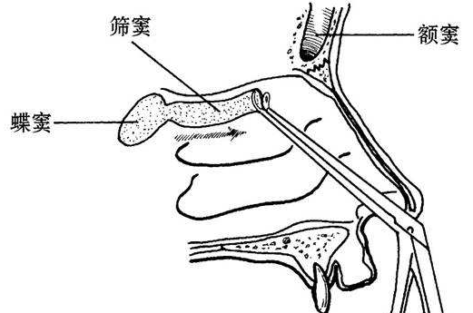 鼻疖的发病病因