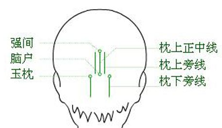 强间穴示意图