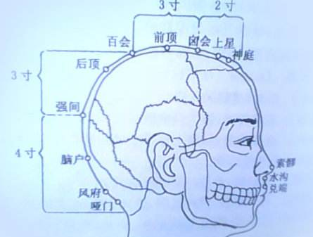 强间穴的刺灸法