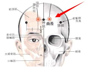 曲差穴穴位配伍