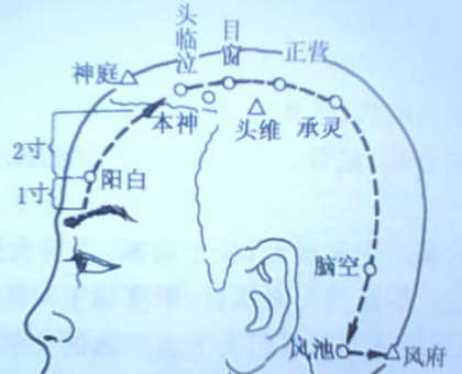 头窍阴穴的示意图