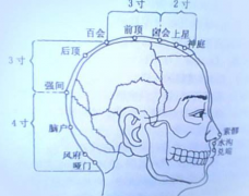 囟会穴位位置及其自灸囟会穴治头痛的方法！