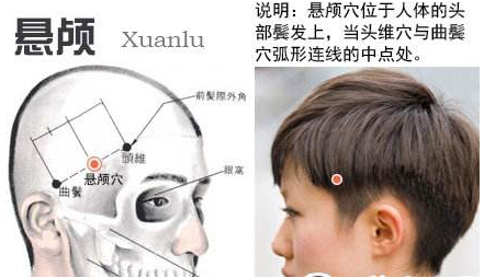 悬颅穴示意图