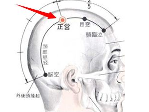 正营穴刺灸法