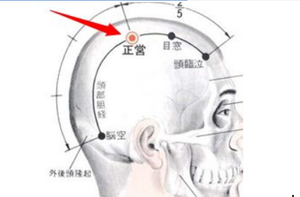 正营穴穴位