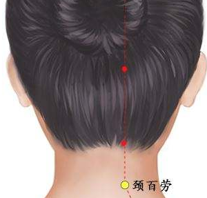 颈百劳穴的针灸