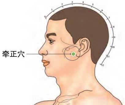 按摩牵正穴治疗面瘫的方法