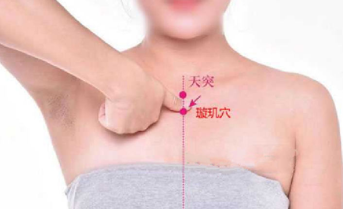 天突穴的取穴方法