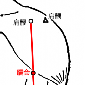 臑会穴的示意图