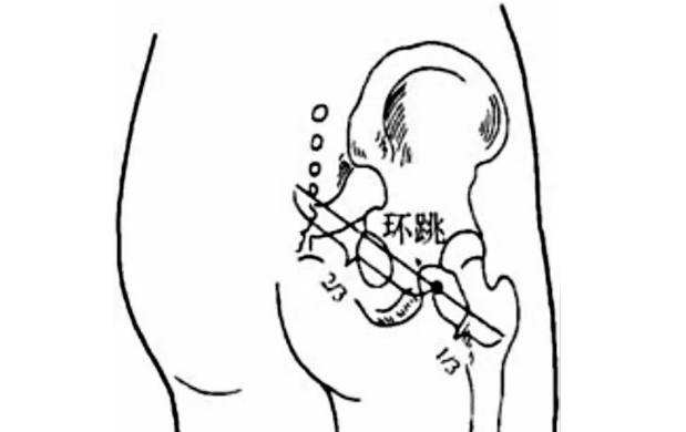 环跳穴主治疾病