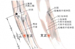 按摩支正穴能治疗尖锐湿疣吗？支正穴的功效与作用