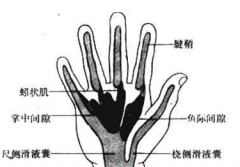 手掌深部间隙感染的预防措施有哪些？手掌深部间隙感染的治疗