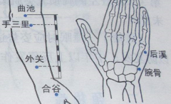 中医治疗落枕的特效穴——腕骨穴，腕骨穴的位置怎么找？
