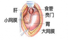 吃不下饭很可能是患上了贲门失弛缓症！贲门失弛缓症的鉴别