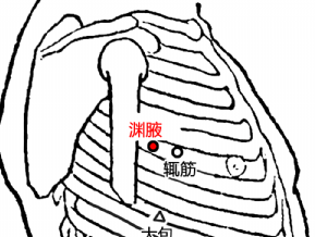 渊腋穴的配伍