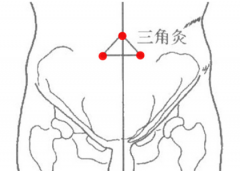 中医灸三角灸穴治疗妇女不孕及其三角灸穴位置！